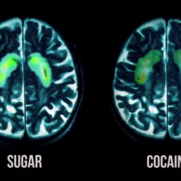 cocaine-sugar-brain